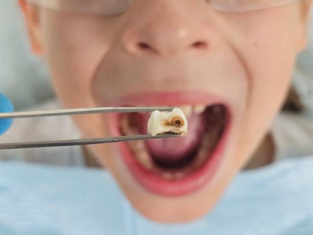 Best Dentist for Dental Trauma  in Edisto, SC